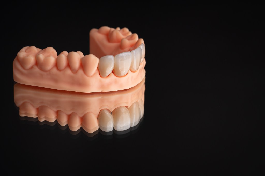 Praca protetyczna, korony cyrkonowe wykonane w laboratorium Holdent GreenLab w Lublinie